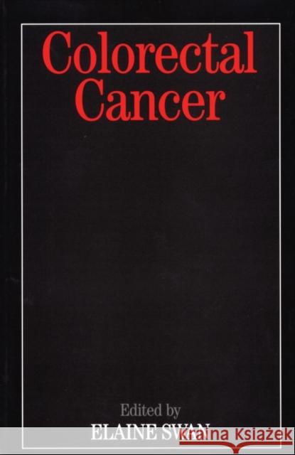 Colorectal Cancer Elaine Swan 9781861563347 John Wiley & Sons