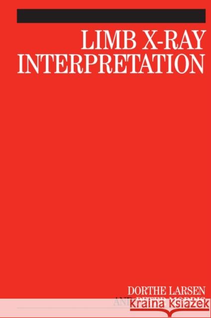 Limb X-Ray Interpretation Dorthe Larsen Peter W. G. Morris 9781861564993