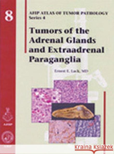 Tumors of the Adrenal Glands and Extraadrenal Paraganglia Robert J. Kurman Silverberg                               Steven G. Silverberg 9781881041016