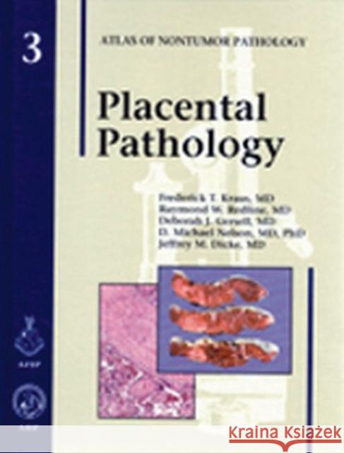 Placental Pathology  9781881041894 American Registry of Pathology