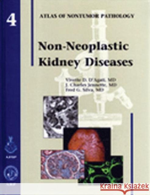 Non-Neoplastic Kidney Diseases: Fascicle 4  9781881041962 American Registry of Pathology