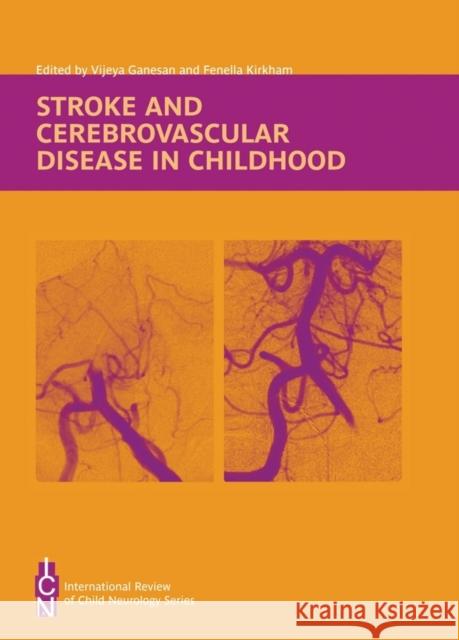 Stroke and Cerebrovascular Disease in Childhood Fenella Kirkham Vijeya Ganesan Peter G. Procopis 9781898683346 Mac Keith Press