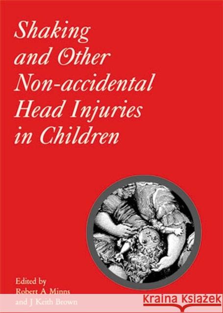 Shaking and Other Non-Accidental Head Injuries in Children Robert A. Minns J. Keith Brown 9781898683353 Mac Keith Press