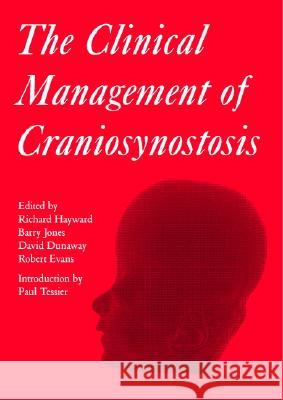 The Clinical Management of Craniosynostosis Richard Haywood David Dunaway Robert Evans 9781898683360 Cambridge University Press