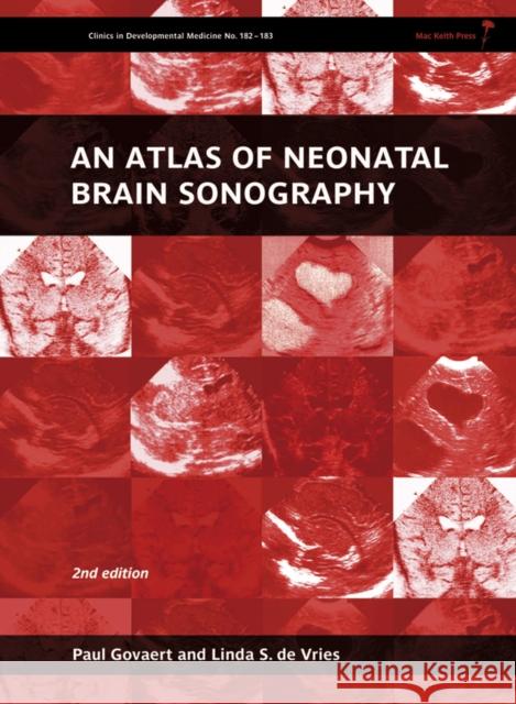 An Atlas of Neonatal Brain Sonography Paul Govaert Linda S. D 9781898683568 Mac Keith Press