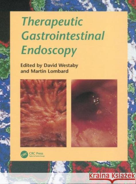 Therapeutic Gastrointestinal Endoscopy a Problem-Oriented Approach Westaby, David 9781899066957 Taylor & Francis Group