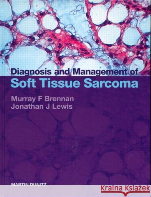 Diagnosis and Management of Soft Tissue Sarcoma Murray F. Brennan Jonathan J. Lewis Brennan Brennan 9781901865141 Taylor & Francis Group