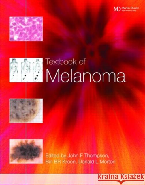 Textbook of Melanoma: Pathology, Diagnosis and Management Thompson, John F. 9781901865653 Martin Dunitz