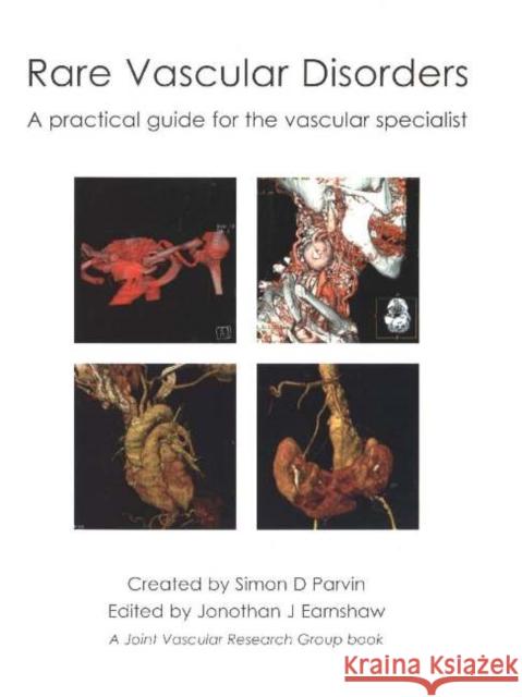 Rare Vascular Disorders: A Practical Guide for the Vascular Specialist Earnshaw, Jonothan J. 9781903378328