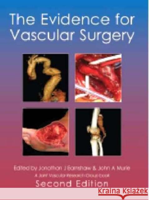 The Evidence for Vascular Surgery; Second Edition Earnshaw, Jonothan J. 9781903378458 TFM PUBLISHING LTD