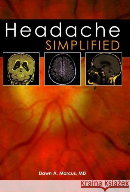 Headache Simplified Dawn, M. D. Marcus 9781903378670 TFM PUBLISHING LTD