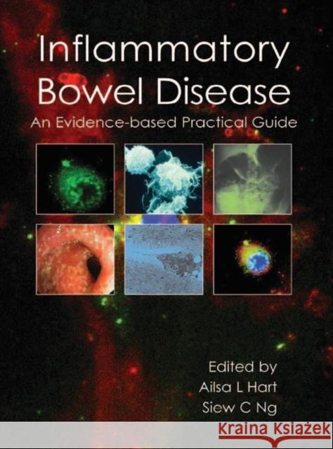 Inflammatory Bowel Disease: An Evidence-Based Practical Guide Hart, Ailsa L. 9781903378823 TFM Publishing Ltd