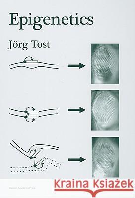 Epigenetics Jorg Tost Jorg Tost 9781904455233 Caister Academic Press