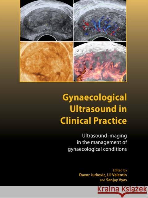 Gynaecological Ultrasound in Clinical Practice: Ultrasound Imaging in the Management of Gynaecological Conditions Jurkovic, Davor 9781904752295 RCOG Press