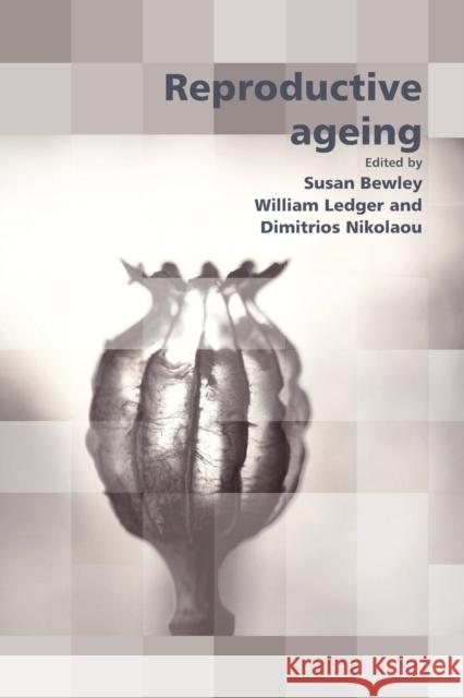 Reproductive Ageing  9781906985134 RCOG Press