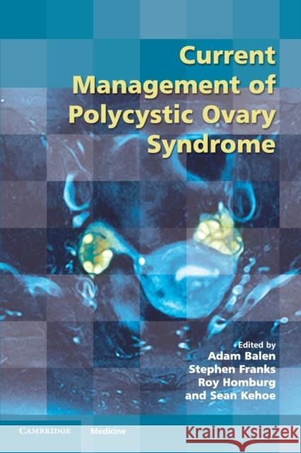 Current Management of Polycystic Ovary Syndrome  9781906985417 RCOG Press