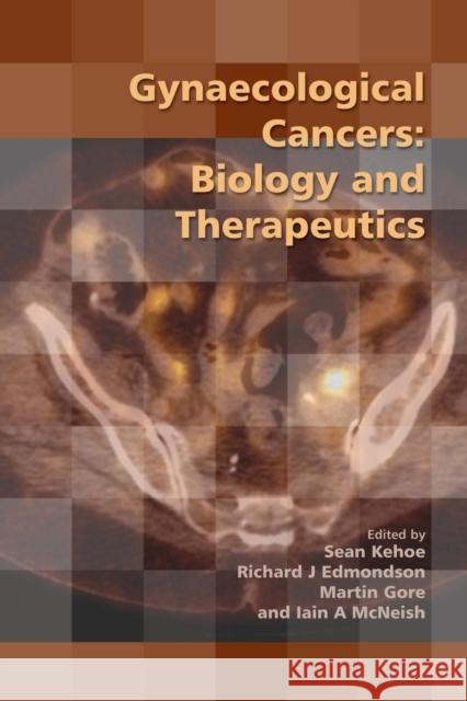 Gynaecological Cancers: Biology and Therapeutics Kehoe, Sean 9781906985448 RCOG Press