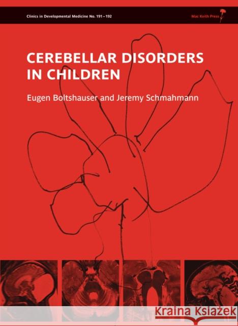 Cerebellar Disorders in Children Eugen Boltshauser Jeremy Schmahmann 9781907655012 Mac Keith Press