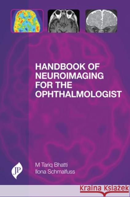 Handbook of Neuroimaging for the Ophthalmologist M. Tariq Bhatti 9781907816130