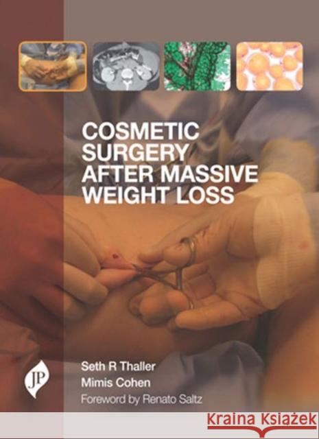 Cosmetic Surgery after Massive Weight Loss Seth R. Thaller Mimis N. Cohen  9781907816284 JP Medical Ltd