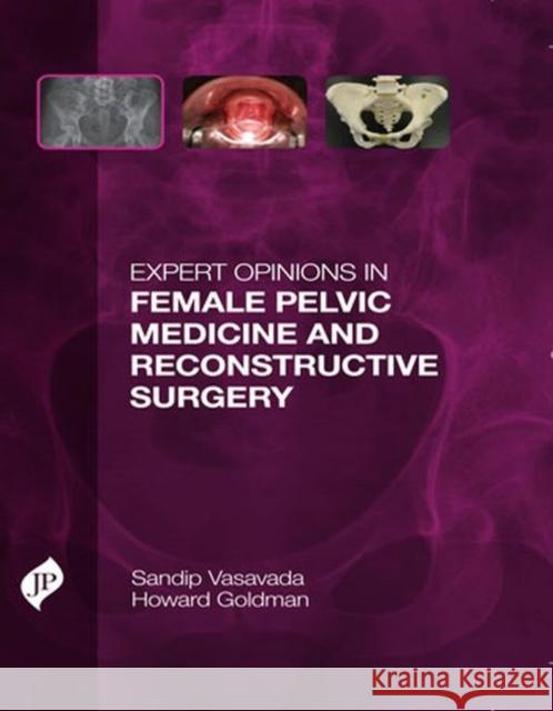 Expert Opinions in Female Pelvic Medicine and Reconstructive Surgery Sandip Vasavada 9781907816291 Jp Medical Ltd