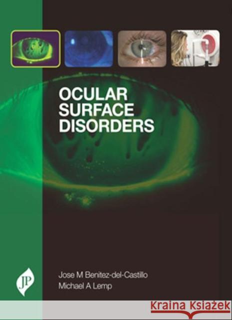 Ocular Surface Disorders Jose M. Benitez-Del-Castillo Michael A. Lemp  9781907816314