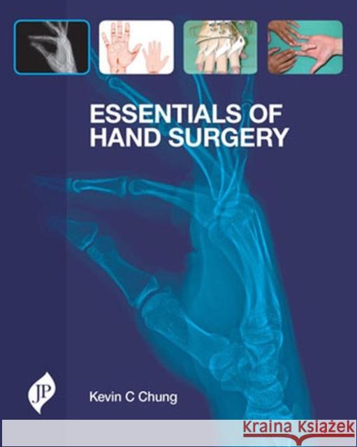 Essentials of Hand Surgery Kevin C., Ed. Chung 9781907816321 Jp Medical Ltd