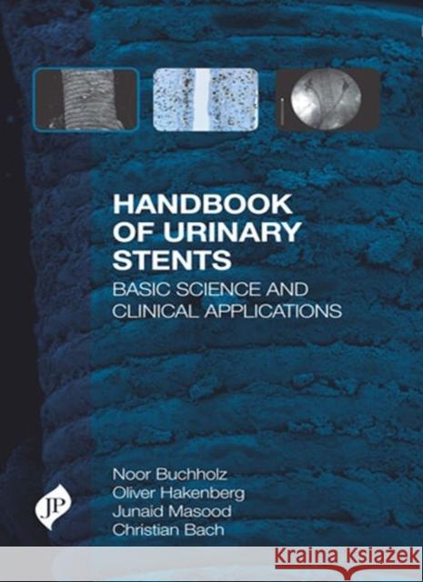Handbook of Urinary Stents Buchholz, Noor 9781907816659