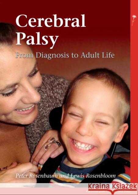 Cerebral Palsy: From Diagnosis to Adult Life Rosenbloom, Lewis 9781908316509