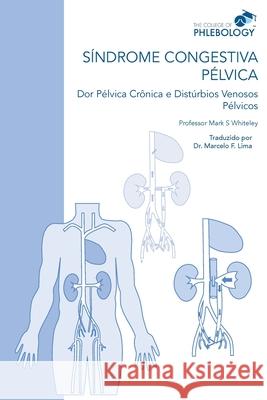 SÍNDROME CONGESTIVA PÉLVICA Dor Pélvica Crônica e Distúrbios Venosos Pélvicos Mark S Whiteley 9781908586094 Whiteley Publishing Ltd