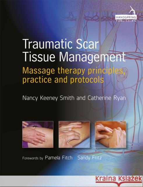 Traumatic Scar Tissue Management: Principles and Practice for Manual Therapy Nancy Keeney Smith Catherine Ryan  9781909141223 Jessica Kingsley Publishers