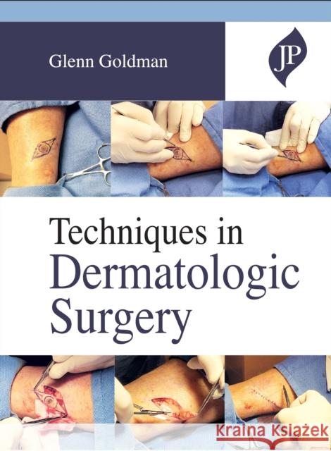 Techniques in Dermatologic Surgery Glenn Goldman 9781909836037