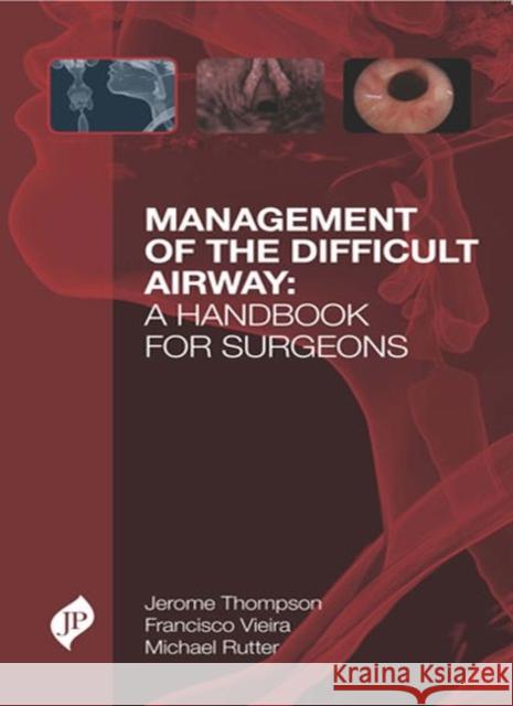 Management of the Difficult Airway: A Handbook for Surgeons Jerome W Thompson 9781909836051