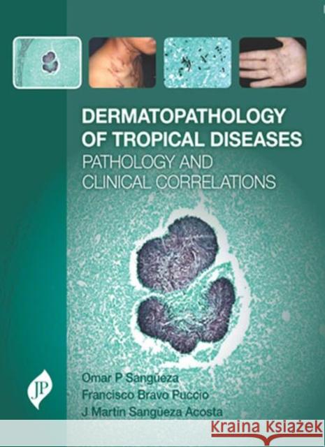 Dermatopathology of Tropical Diseases Omar P. Sangueza 9781909836068 Jp Medical Ltd
