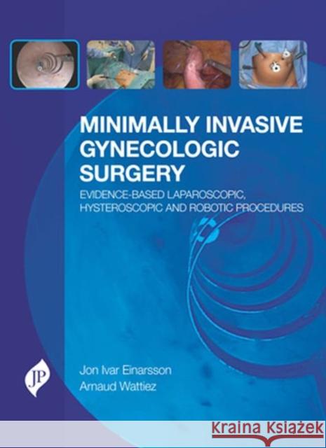 Minimally Invasive Gynecologic Surgery: Evidence-Based Laparoscopic, Hysteroscopic & Robotic Surgeries Jon Ivar Einarsson Arnaud Wattiez  9781909836099 JP Medical Ltd