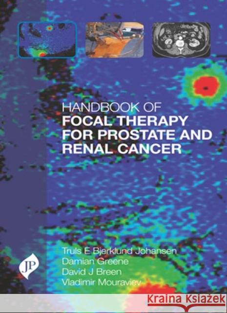 Handbook of Focal Therapy for Prostate and Renal Cancer Truls E. Bjerklund Johansen Damian Greene  9781909836112 JP Medical Ltd