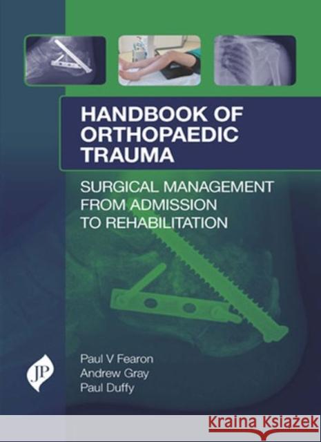 Handbook of Orthopaedic Trauma Paul V. Fearon 9781909836150