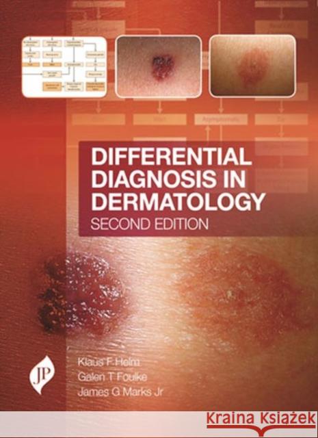 Differential Diagnosis in Dermatology: Second Edition Helm, Klaus F. 9781909836198