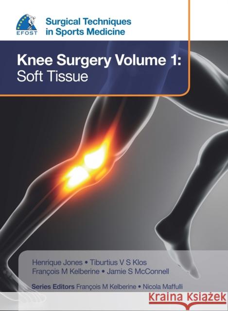 Efost Surgical Techniques in Sports Medicine - Knee Surgery Vol.1: Soft Tissue Henrique Jones 9781909836372 JP Medical Ltd