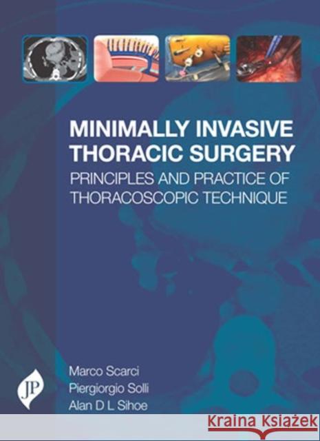 Minimally Invasive Thoracic Surgery Marco Scarci 9781909836402 Jp Medical Ltd