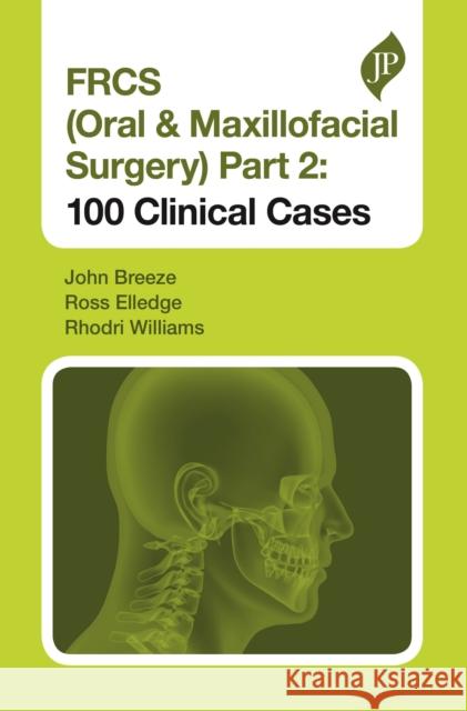 Frcs (Oral & Maxillofacial Surgery) Part 2: 100 Clinical Cases John Breeze 9781909836839