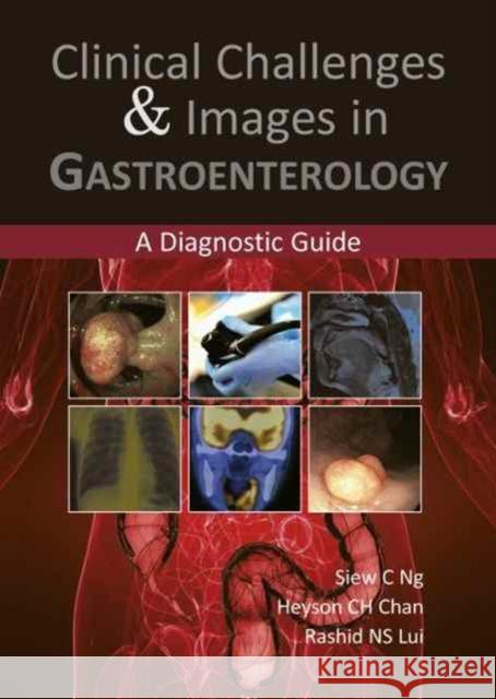 Clinical Challenges & Images in Gastroenterology: A Diagnostic Guide Dr. C. Ng Siew, MBBS, MRCP, PhD Dr. C. H. Chan Heyson, MBChB, MRCP Dr. N. S. Lui Rashid, MBChB, MRCP 9781910079034 TFM Publishing Ltd