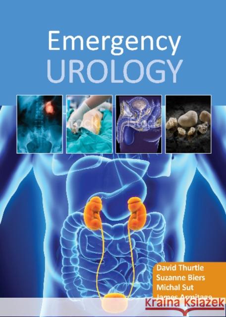 Emergency Urology David Thurtle Suzanne Biers, BSc, MBBS, MD, FRCS (Urol Michal Sut, MMedSci, FRCS (Urol) 9781910079423