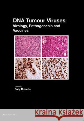 DNA Tumour Viruses: Virology, Pathogenesis and Vaccines Sally Roberts 9781910190791 Caister Academic Press