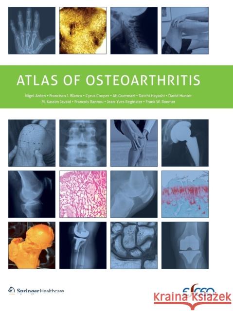 Atlas of Osteoarthritis Nigel Arden Francisco Blanco Cyrus Cooper 9781910315156 Springer Healthcare