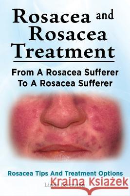 Rosacea and Rosacea Treatment. From A Rosacea Sufferer To A Rosacea Sufferer. Rosacea Tips And Treatment Options Leverston, Linda 9781910941881 Imb Publishing Rosacea Rosacea Treatment