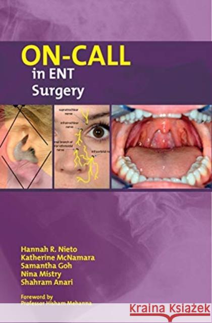 On-Call in ENT Surgery Hannah Nieto Katherine McNamara Samantha Goh 9781911450726 Libri Publishing