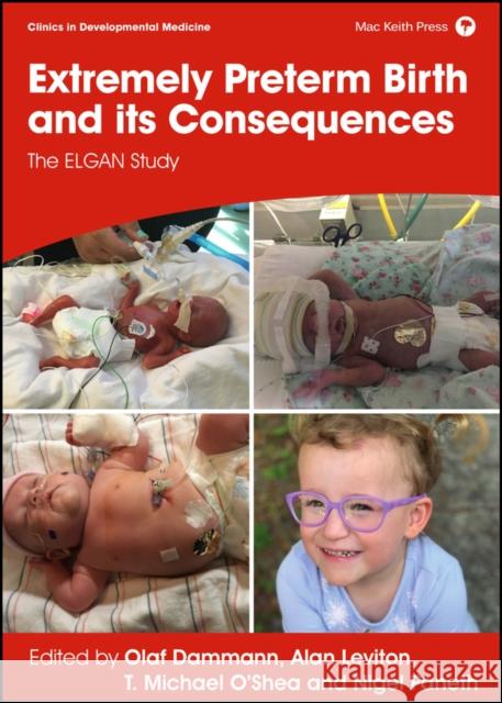 Extremely Preterm Birth and Its Consequences: The Elgan Study Dammann, Olaf 9781911488965