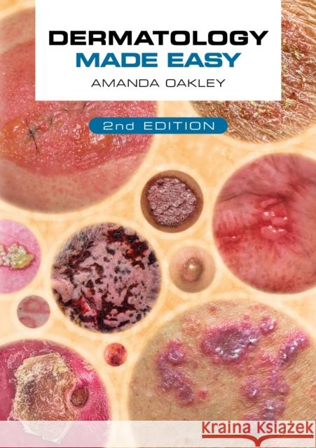 Dermatology Made Easy, second edition Amanda (Adjunct Associate Professor, Department of Medicine, University of Auckland, New Zealand) Oakley 9781914961168