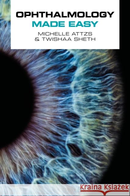 Ophthalmology Made Easy Twishaa Sheth 9781914961373 Scion Publishing Ltd